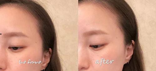 吃瓜能去眼袋吗,揭秘日常小零食的神奇功效